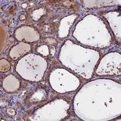 ACOX3 Antibody, Novus Biologicals:Antibodies:Primary Antibodies